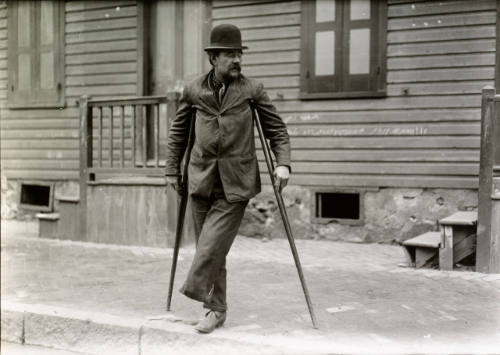 Handicapped: Crippled Steel Worker,  Bethlehem, PA