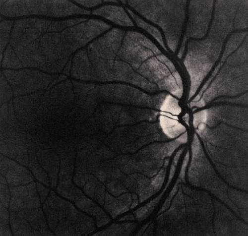 Retinas  [diptych]