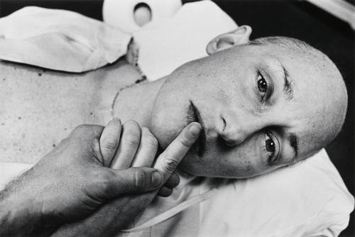 Final Treatment, Boston, Massachusetts