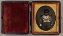 case open recto overall