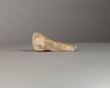 Right Oblique