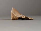Right oblique