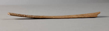 Right oblique