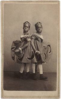 Millie and Christine McCoy, Siamese Twins