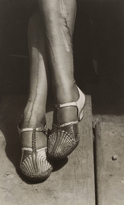A sign of the times--Depression--mended stockings, stenographer