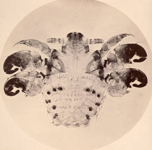 Photomicrograph of a Crab Louse