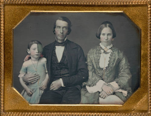 Portrait of a Family, girl with eye patch