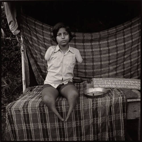Kangra, India ("Crippled Child")