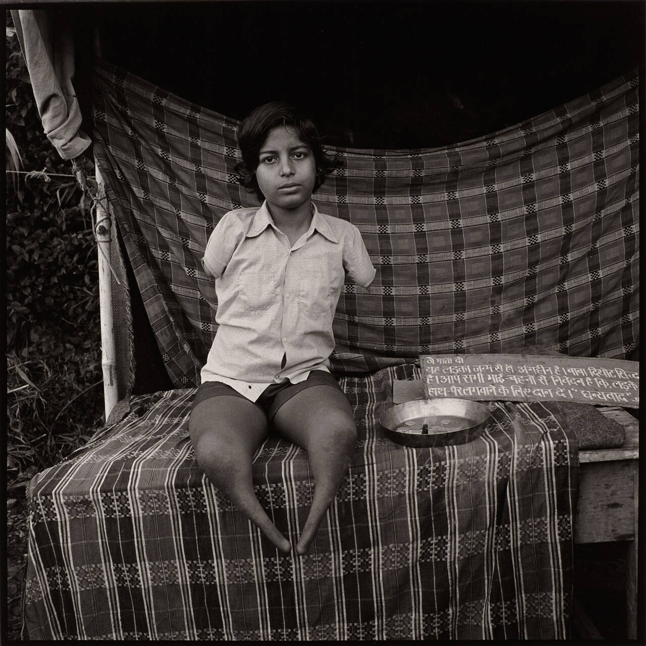Kangra, India ("Crippled Child")