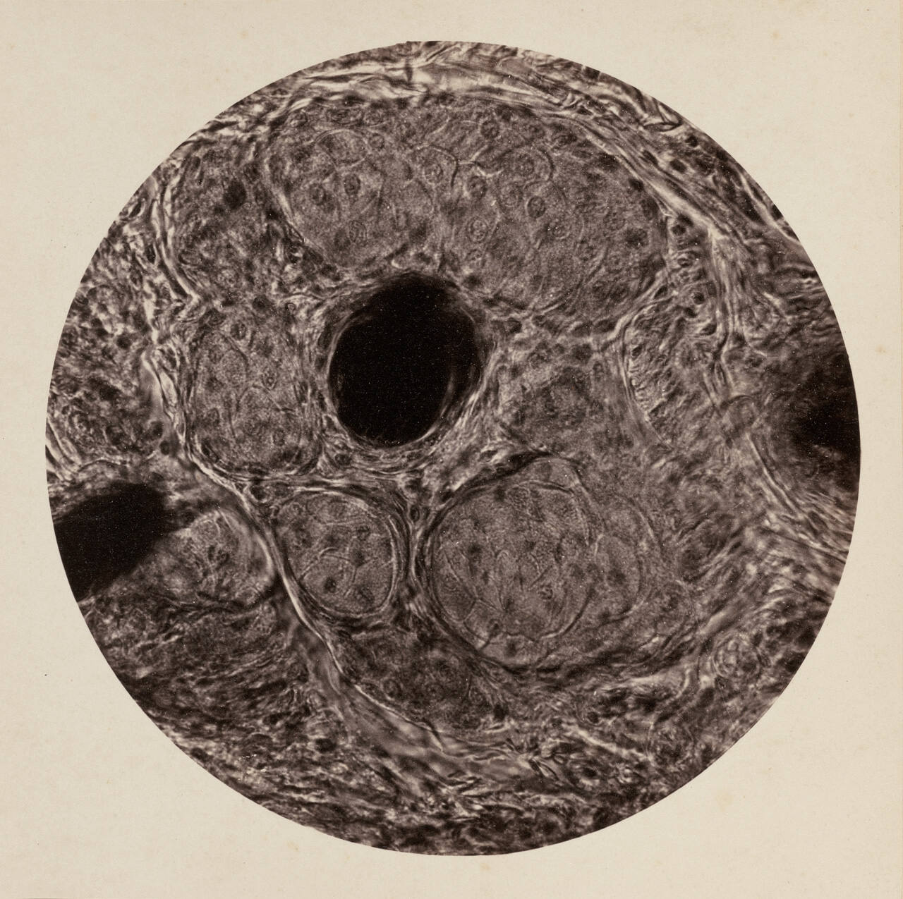 Sebaceous Glands in Eyelid of Calf