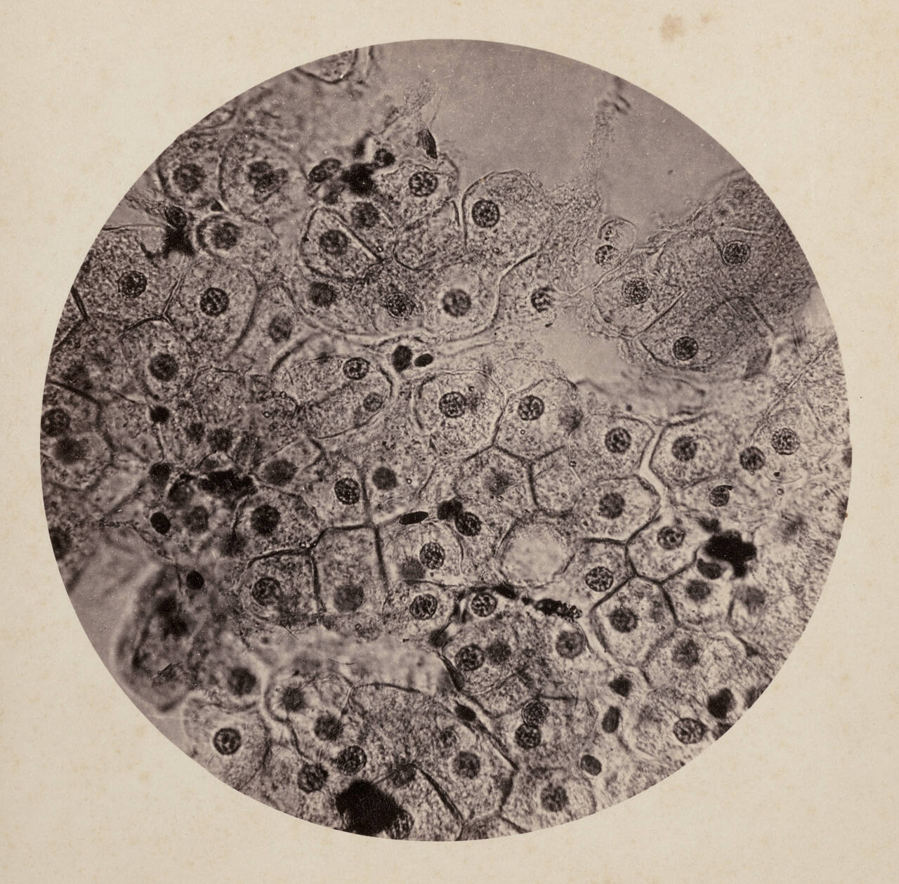 Section of liver of pseudo-triton